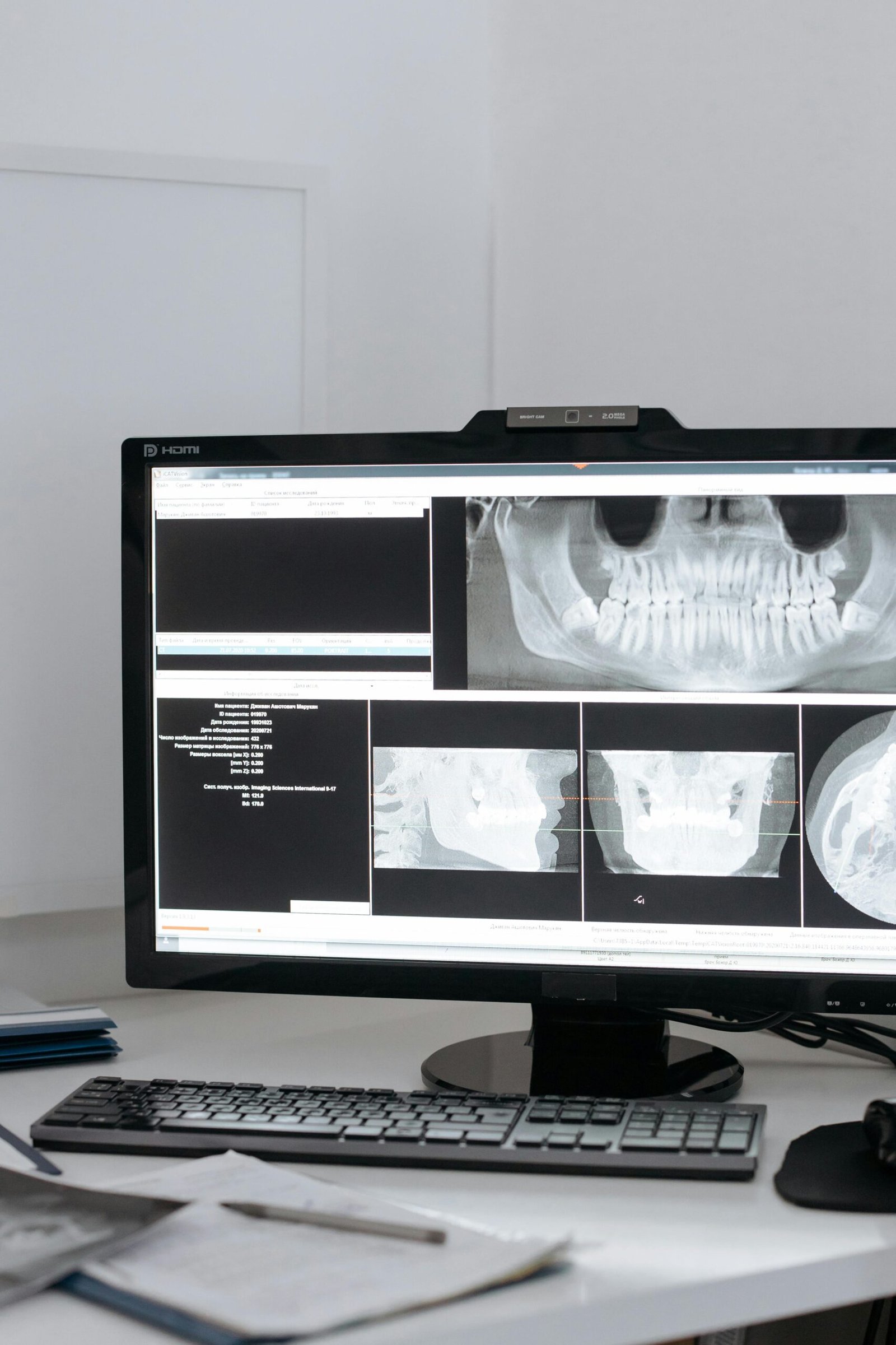 Closeup of dental x-ray images displayed on a computer monitor in a dental clinic setting.